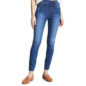 Madewell 4-Button 10" High-rise Skinny Jeans